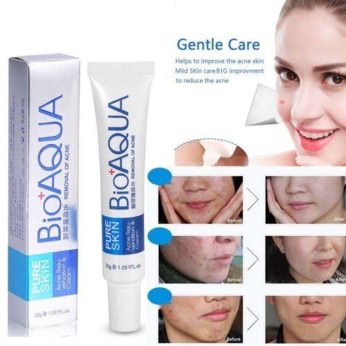 BIOAQUA Acne Cream 30g tube for acne and scar treatment