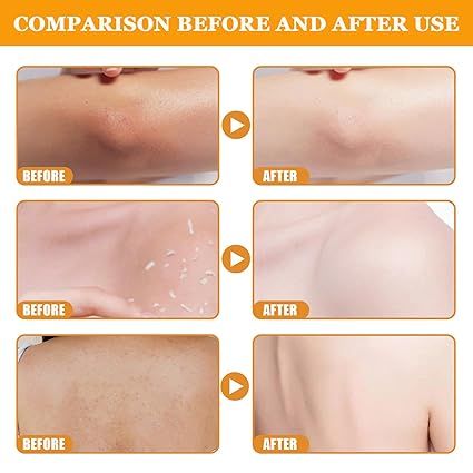 Person gently massaging orange exfoliating gel onto their face